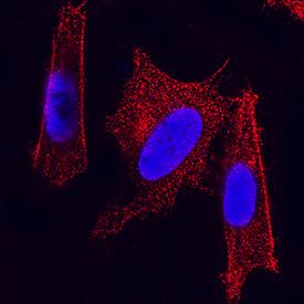 Enolase 2/Neuron-specific Enolase was detected in immersion fixed SH-SY5Y human neuroblastoma cell line using Mouse Anti-Human Enolase 2/Neuron-specific Enolase Monoclonal Antibody (Catalog # MAB5169) at 8 µg/mL for 3 hours at room temperature. Cells were stained using the NorthernLights™ 557-conjugated Anti-Mouse IgG Secondary Antibody (red; Catalog # NL007) and counterstained with DAPI (blue). Specific staining was localized to plasma membrane and cytoplasm. View our protocol for Fluorescent ICC Staining of Cells on Coverslips.