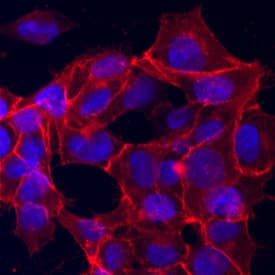 EpCAM/TROP-1 was detected in immersion fixed BG01V human embryonic stem cells using Goat Anti-Human EpCAM/TROP-1 Antigen Affinity-purified Polyclonal Antibody (Catalog # AF960) at 10 µg/mL for 3 hours at room temperature. Cells were stained using the NorthernLights™ 557-conjugated Anti-Goat IgG Secondary Antibody (red; Catalog # NL001) and counterstained with DAPI (blue). Specific staining was localized to cytoplasm and cell membrane. View our protocol for Fluorescent ICC Staining of Cells on Coverslips.