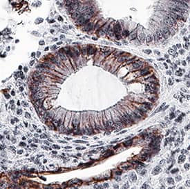 Immunohistochemistry EpCAM/TROP1 Antibody [Unconjugated]