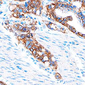 Immunohistochemistry EpCAM/TROP1 Antibody (158210) [Unconjugated]
