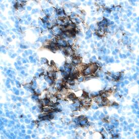 Immunohistochemistry EphA1 Antibody