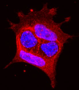 Immunocytochemistry EphA1 Antibody [Unconjugated]