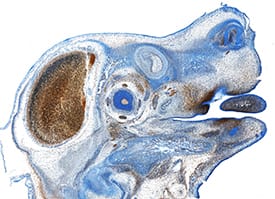 Immunohistochemistry EphA3 Antibody [Unconjugated]