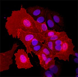 EphA5 was detected in immersion fixed MCF-7 human breast cancer cell line using Goat Anti-Human/Rat EphA5 Antigen Affinity-purified Polyclonal Antibody (Catalog # AF541) at 10 µg/mL for 3 hours at room temperature. Cells were stained using the NorthernLights™ 557-conjugated Anti-Goat IgG Secondary Antibody (red; Catalog # NL001) and counterstained with DAPI (blue). Specific staining was localized to transmembrane proteins. View our protocol for Fluorescent ICC Staining of Cells on Coverslips.