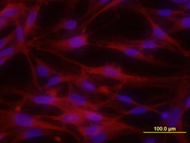 Immunocytochemistry EphA5 Antibody (86731) [Unconjugated]