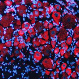 EphB1 was detected in perfusion fixed frozen sections of rat brain (dorsal root ganglia) using Mouse Anti-Rat EphB1 Monoclonal Antibody (Catalog # MAB5422) at 25 µg/mL overnight at 4 °C. Tissue was stained using the NorthernLights™ 557-conjugated Anti-Mouse IgG Secondary Antibody (red; Catalog # NL007) and counterstained with DAPI (blue). Specific staining was localized to cytoplasm in small-sized neurons. View our protocol for Fluorescent IHC Staining of Frozen Tissue Sections.