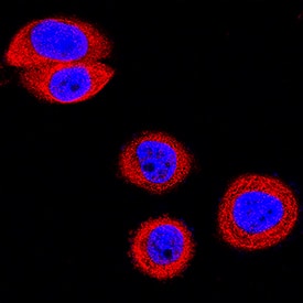EphB2 was detected in immersion fixed MBA-MB-468 human breast cancer cell line using Goat Anti-Human/Mouse EphB2 Antigen Affinity-purified Polyclonal Antibody (Catalog # AF467) at 5 µg/mL for 3 hours at room temperature. Cells were stained using the NorthernLights™ 557-conjugated Anti-Goat IgG Secondary Antibody (red; Catalog # NL001) and counterstained with DAPI (blue). Specific staining was localized to cytoplasm. View our protocol for Fluorescent ICC Staining of Cells on Coverslips.