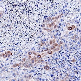 Immunohistochemistry EphB2 Antibody [Unconjugated]