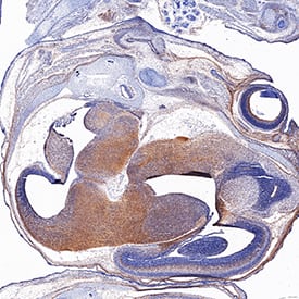 EphB2 was detected in immersion fixed frozen sections of mouse embryo (13 d.p.c.) using Goat Anti-Human/Mouse EphB2 Antigen Affinity-purified Polyclonal Antibody (Catalog # AF467) at 1.7 µg/mL for 1 hour at room temperature followed by incubation with the Anti-Goat IgG VisUCyte™ HRP Polymer Antibody (Catalog # VC004). Tissue was stained using DAB (brown) and counterstained with hematoxylin (blue). Specific staining was localized to developing brain. View our protocol for IHC Staining with VisUCyte HRP Polymer Detection Reagents.