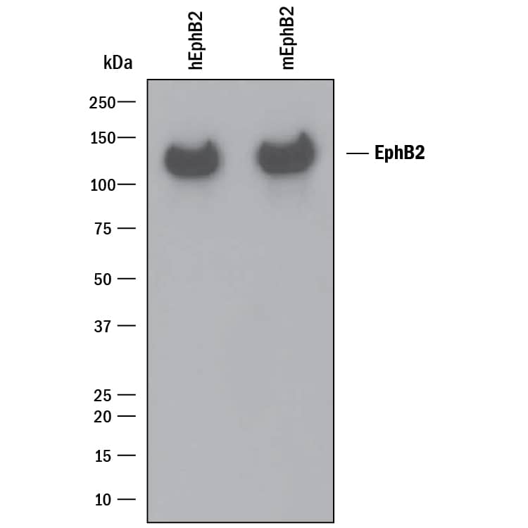 Western Blot EphB2 Antibody [Unconjugated]