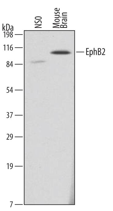 Western blot shows lysates of mouse brain tissue. PVDF membrane was probed with 2 µg/mL of Rat Anti-Mouse EphB2 Monoclonal Antibody (Catalog # MAB4672) followed by HRP-conjugated Anti-Rat IgG Secondary Antibody (Catalog # HAF005). A specific band was detected for EphB2 at approximately 110 kDa (as indicated). This experiment was conducted under reducing conditions and using Immunoblot Buffer Group 1.