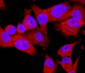 EphB2 was detected in immersion fixed MDA-MB-231 human breast cancer cell line using Rat Anti-Human/Mouse EphB2 Monoclonal Antibody (Catalog # MAB467) at 10 µg/mL for 3 hours at room temperature. Cells were stained using the NorthernLights™ 557-conjugated Anti-Rat IgG Secondary Antibody (red; Catalog # NL013) and counterstained with DAPI (blue). Specific staining was localized to cytoplasm. View our protocol for Fluorescent ICC Staining of Cells on Coverslips.