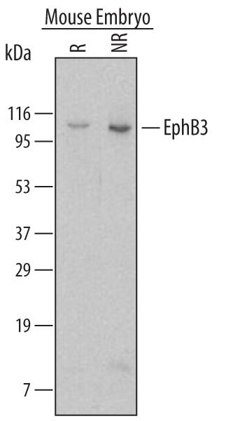 Western blot shows lysates of mouse brain tissue. PVDF membrane was probed with 2 µg/mL of Rat Anti-Mouse EphB3 Monoclonal Antibody (Catalog # MAB432) followed by HRP-conjugated Anti-Rat IgG Secondary Antibody (HAF005). A specific band was detected for EphB3 at approximately 130 kDa (as indicated). This experiment was conducted under reducing conditions and using Immunoblot Buffer Group 1.