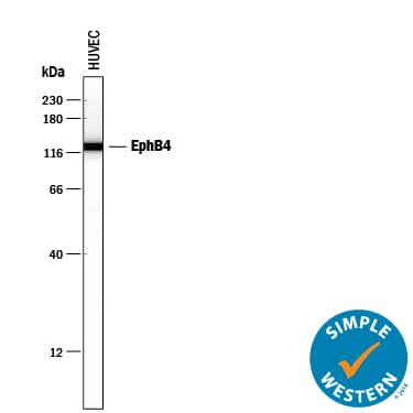 Simple Western lane view shows lysates of HUVEC human umbilical vein endothelial cells, loaded at 0.2 mg/mL. A specific band was detected for EphB4 at approximately 127 kDa (as indicated) using 50 µg/mL of Goat Anti-Human EphB4 Antigen Affinity-purified Polyclonal Antibody (Catalog # AF3038) followed by 1:50 dilution of HRP-conjugated Anti-Goat IgG Secondary Antibody (Catalog # HAF109). This experiment was conducted under reducing conditions and using the 12-230 kDa separation system.