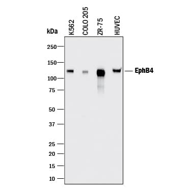 Western blot shows lysates of K562 human chronic myelogenous leukemia cell line, COLO 205 human colorectal adenocarcinoma cell line, ZR-75 human breast cancer cell line, and HUVEC human umbilical vein endothelial cells. PVDF membrane was probed with 2 µg/mL of Goat Anti-Human EphB4 Antigen Affinity-purified Polyclonal Antibody (Catalog # AF3038) followed by HRP-conjugated Anti-Goat IgG Secondary Antibody (Catalog # HAF017). A specific band was detected for EphB4 at approximately 120 kDa (as indicated). This experiment was conducted under reducing conditions and using Immunoblot Buffer Group 1.