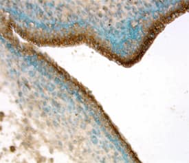 EphB4 was detected in immersion fixed frozen sections of mouse embryo (15 d.p.c.) using Goat Anti-Mouse EphB4 Antigen Affinity-purified Polyclonal Antibody (Catalog # AF446) at 15 µg/mL overnight at 4 °C. Tissue was stained using the Anti-Goat HRP-DAB Cell & Tissue Staining Kit (brown; Catalog # CTS008) and counterstained with hematoxylin (blue). View our protocol for Chromogenic IHC Staining of Frozen Tissue Sections.