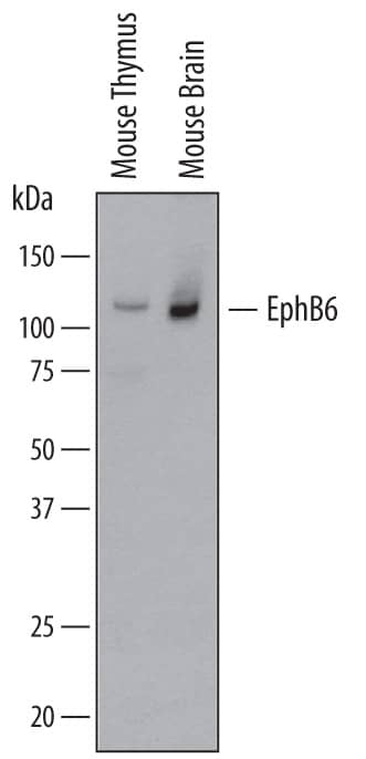 Western Blot EphB6 Antibody