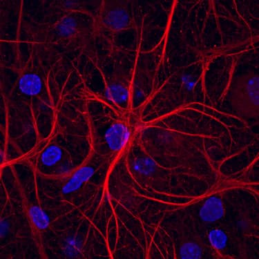 Ephrin-B2 was detected in immersion fixed rat hippocampal neurons using Goat Anti-Mouse Ephrin-B2 Biotinylated Antigen Affinity-purified Polyclonal Antibody (Catalog # BAF496) at 10 µg/mL for 3 hours at room temperature. Cells were stained using the NorthernLights™ 557-conjugated Streptavidin (red; Catalog # NL999) and counterstained with DAPI (blue). Specific staining was localized to cytoplasm and cell surface. View our protocol for Fluorescent ICC Staining of Non-adherent Cells.