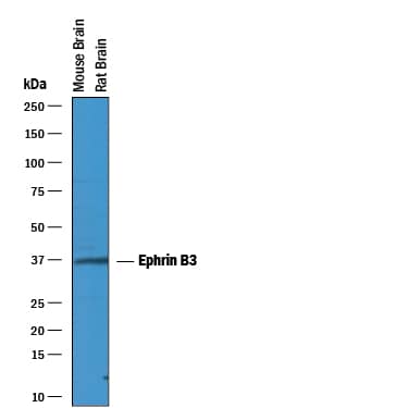 Western blot shows lysates of mouse brain tissue and rat brain tissue. PVDF membrane was probed with 1 µg/mL of Goat Anti-Human Ephrin-B3 Antigen Affinity-purified Polyclonal Antibody (Catalog # AF395) followed by HRP-conjugated Anti-Goat IgG Secondary Antibody (Catalog # HAF019). A specific band was detected for Ephrin-B3 at approximately 36 kDa (as indicated). This experiment was conducted under reducing conditions and using Immunoblot Buffer Group 1.