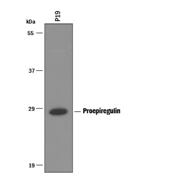Western blot shows lysates of P19 mouse embryonal carcinoma cell line. PVDF Membrane was probed with 1 µg/mL of Goat Anti-Mouse Epiregulin Antigen Affinity-purified Polyclonal Antibody (Catalog # AF1068) followed by HRP-conjugated Anti-Goat IgG Secondary Antibody (Catalog # HAF019). A specific band was detected for Proepiregulin at approximately 28 kDa (as indicated). This experiment was conducted under reducing conditions and using Immunoblot Buffer Group 8.