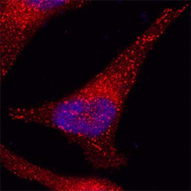Immunocytochemistry EPS15 Antibody [Unconjugated]