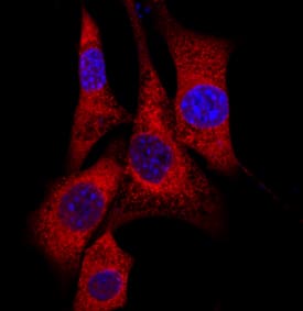 Immunocytochemistry EPS15 Antibody [Unconjugated]