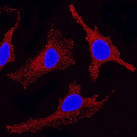 Eps15 was detected in immersion fixed HeLa human cervical epithelial carcinoma cell line using Rabbit Anti-Human Eps15 Monoclonal Antibody (Catalog # MAB8480) at 1 µg/mL for 3 hours at room temperature. Cells were stained using the NorthernLights™ 557-conjugated Anti-Rabbit IgG Secondary Antibody (red; Catalog # NL004) and counterstained with DAPI (blue). Specific staining was localized to cytoplasm. View our protocol for Fluorescent ICC Staining of Cells on Coverslips.
