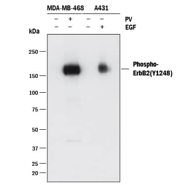 Western blot shows lysates of MDA-MB-468 human breast cancer cell line and A431 human epithelial carcinoma cell line untreated (-) or treated (+) with 1 mM Pervanadate (PV) for 10 minutes or with 10 ng/mL Recombinant Human EGF (Catalog # 236-EG) for 5 minutes. PVDF membrane was probed with 0.25 µg/mL of Rabbit Anti-Human Phospho-ErbB2/Her2 (Y1248) Antigen Affinity-purified Polyclonal Antibody (Catalog # AF1768) followed by HRP-conjugated Anti-Rabbit IgG Secondary Antibody (Catalog # HAF008). A specific band was detected for Phospho-ErbB2/Her2 (Y1248) at approximately 170 kDa (as indicated). This experiment was conducted under reducing conditions and using Immunoblot Buffer Group 1.