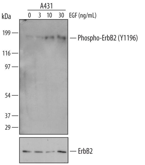 <b>Biological Strategies Validation. </b>Western blot shows lysates of A431 human epithelial carcinoma cell line untreated (-) or treated (+) with the indicated concentration of Recombinant Human EGF (Catalog # 236-EG) for 5 minutes. PVDF membrane was probed with 0.1 µg/mL Rabbit Anti-Human Phospho-ErbB2/Her2 (Y1196) Antigen Affinity-purified Polyclonal Antibody (Catalog # AF4438) followed by HRP-conjugated Anti-Rabbit IgG Secondary Antibody (Catalog # HAF008). A specific band for Phospho-ErbB2/Her2 (Y1196) was detected at approximately 185 kDa (as indicated). For additional reference, duplicate lysates were probed with 1 µg/mL Human ErbB2/Her2 Monoclonal Antibody (lower panel, Catalog # MAB1129). This experiment was conducted under reducing conditions and using Immunoblot Buffer Group 1.