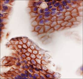 ErbB2/Her2 was detected in perfusion fixed frozen sections of mouse intestine using Sheep Anti-Mouse ErbB2/Her2 Antigen Affinity-purified Polyclonal Antibody (Catalog # AF5176) at 1.7 µg/mL overnight at 4 °C. Tissue was stained using the Anti-Sheep HRP-DAB Cell & Tissue Staining Kit (brown; Catalog # CTS019) and counterstained with hematoxylin (blue). Specific staining was localized to plasma membranes. View our protocol for Chromogenic IHC Staining of Frozen Tissue Sections.