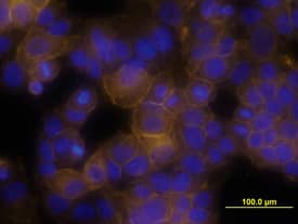 ErbB2/Her2 was detected in immersion fixed MCF-7 human breast cancer cell line using Goat Anti-Human ErbB2/Her2 Biotinylated Antigen Affinity-purified Polyclonal Antibody (Catalog # BAF1129) at 10 µg/mL for 3 hours at room temperature. Cells were stained using the NorthernLights™ 557-conjugated Streptavidin (yellow; Catalog # NL999) and counterstained with DAPI (blue). View our protocol for Fluorescent ICC Staining of Cells on Coverslips.