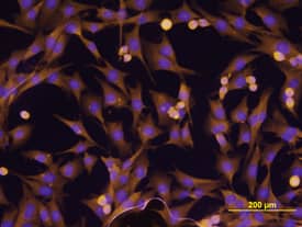ErbB2/Her2 was detected in immersion fixed MDA-MB-231 human breast cancer cell line using Mouse Anti-Human ErbB2/Her2 Monoclonal Antibody (Catalog # MAB1129) at 10 µg/mL for 3 hours at room temperature. Cells were stained using the NorthernLights™ 557-conjugated Anti-Mouse IgG Secondary Antibody (yellow; Catalog # NL007) and counterstained with DAPI (blue). View our protocol for Fluorescent ICC Staining of Cells on Coverslips.