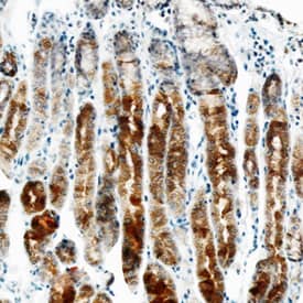 ErbB2/Her2 was detected in immersion fixed paraffin-embedded sections of human stomach using Mouse Anti-Human ErbB2/Her2 Monoclonal Antibody (Catalog # MAB1129) at 15 µg/mL overnight at 4 °C. Tissue was stained using the Anti-Mouse HRP-DAB Cell & Tissue Staining Kit (brown; Catalog # CTS002) and counterstained with hematoxylin (blue). Specific staining was localized to plasma membrane/cytoplasm in glans and villi. View our protocol for Chromogenic IHC Staining of Paraffin-embedded Tissue Sections.