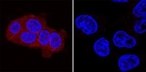 ErbB3/Her3 was detected in immersion fixed MCF-7 human breast cancer cell line (left panel) and MDA-MD-231 human breast cancer cell line (right panel) using Sheep Anti-Mouse ErbB3/Her3 Antigen Affinity-purified Polyclonal Antibody (Catalog # AF4518) at 5 µg/mL for 3 hours at room temperature. Cells were stained using the NorthernLights™ 557-conjugated Anti-Sheep IgG Secondary Antibody (red; Catalog # NL010) and counterstained with DAPI (blue). Specific staining was localized to cytoplasm. View our protocol for Fluorescent ICC Staining of Cells on Coverslips.