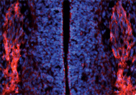 ErbB3/Her3 was detected in immersion fixed frozen sections of embryonic mouse dorsal root ganglion (E10.5) using 10 µg/mL Sheep Anti-Mouse ErbB3/Her3 Antigen Affinity-purified Polyclonal Antibody (Catalog # AF4518) overnight at 4 °C. Tissue was stained with the NorthernLights™ 557-conjugated Anti-Sheep IgG Secondary Antibody (red; Catalog # NL010) and counterstained with DAPI (blue). View our protocol for Fluorescent IHC Staining of Frozen Tissue Sections.