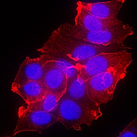 ErbB4/Her4 was detected in immersion fixed MCF-7 human breast cancer cell line using Goat Anti-Human ErbB4/Her4 Antigen Affinity-purified Polyclonal Antibody (Catalog # AF1131) at 10 µg/mL for 3 hours at room temperature. Cells were stained using the NorthernLights™ 557-conjugated Anti-Goat IgG Secondary Antibody (red; Catalog # NL001) and counterstained with DAPI (blue). Specific staining was localized to plasma membrane. View our protocol for Fluorescent ICC Staining of Cells on Coverslips.