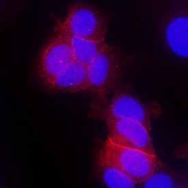 Immunocytochemistry ErbB4/Her4 Antibody (182803) [Unconjugated]