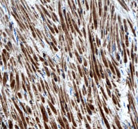 Immunohistochemistry ErbB4/Her4 Antibody (182803) [Unconjugated]