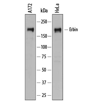 Western blot shows lysates of A172 human glioblastoma cell line and HeLa human cervical epithelial carcinoma cell line. PVDF membrane was probed with 0.2 µg/mL of Sheep Anti-Human Erbin Antigen Affinity-purified Polyclonal Antibody (Catalog # AF7866) followed by HRP-conjugated Anti-Sheep IgG Secondary Antibody (Catalog # HAF016). A specific band was detected for Erbin at approximately 180 kDa (as indicated). This experiment was conducted under reducing conditions and using Immunoblot Buffer Group 1.
