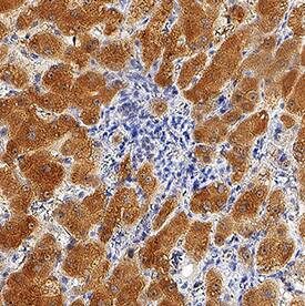 Erythropoietin/EPO was detected in immersion fixed paraffin-embedded sections of human liver using Mouse Anti-Human Erythropoietin/EPO Monoclonal Antibody (Catalog # MAB2873) at 5 µg/mL for 1 hour at room temperature followed by incubation with the Anti-Mouse IgG VisUCyte™ HRP Polymer Antibody (Catalog # VC001). Before incubation with the primary antibody, tissue was subjected to heat-induced epitope retrieval using Antigen Retrieval Reagent-Basic (Catalog # CTS013). Tissue was stained using DAB (brown) and counterstained with hematoxylin (blue). Specific staining was localized to cytoplasm in hepatocytes. View our protocol for IHC Staining with VisUCyte HRP Polymer Detection Reagents.