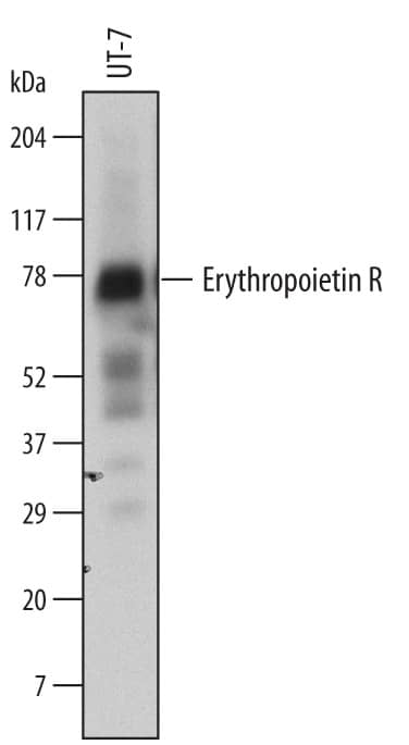Western blot shows lysates of UT-7 human acute myeloid leukemia cell line. PVDF membrane was probed with 1 µg/mL of Goat Anti-Human Erythropoietin R Antigen Affinity-purified Polyclonal Antibody (Catalog # AF-322-PB) followed by HRP-conjugated Anti-Goat IgG Secondary Antibody (Catalog # HAF109). Specific bands were detected for Erythropoietin R at approximately 70-78 kDa (as indicated). This experiment was conducted under reducing conditions and using Immunoblot Buffer Group 1.