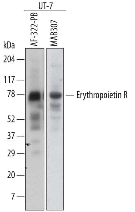 Western blot shows lysates of UT-7 human acute myeloid leukemia cell line. PVDF membrane was probed with 2 µg/mL of Mouse Anti-Human Erythropoietin R Monoclonal Antibody (Catalog # MAB307) followed by HRP-conjugated Anti-Mouse IgG Secondary Antibody (Catalog # HAF007). For additional reference, PVDF membrane was probed with 1 µg/mL of Goat Anti-Human Erythropoietin R Antigen Affinity-purified Polyclonal Antibody (Catalog # AF-322-PB) followed by HRP-conjugated Anti-Goat IgG Secondary Antibody (Catalog # HAF109). A specific band was detected for Erythropoietin R at approximately 70 kDa (as indicated). This experiment was conducted under reducing conditions and using Immunoblot Buffer Group 1.