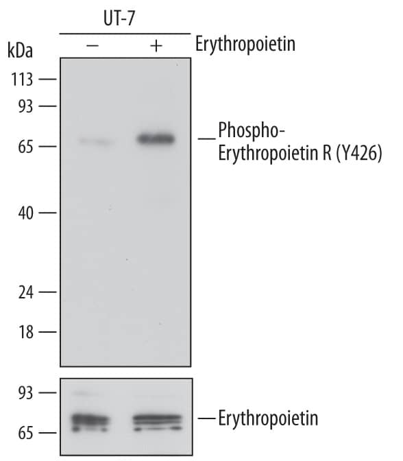 Western blot shows lysates of UT-7 human acute myeloid leukemia cell line untreated (-) or treated (+) with 300 ng/mL Recombinant Human Erythropoietin (Tissue Culture Grade) (Catalog # 287-TC) for 10 minutes. PVDF membrane was probed with 1 µg/mL of Mouse Anti-Human Phospho-Erythropoietin R (Y426) Monoclonal Antibody (Catalog # MAB6926) followed by HRP-conjugated Anti-Mouse IgG Secondary Antibody (Catalog # HAF007). A specific band was detected for Phospho-Erythropoietin R (Y426) at approximately 64 to 70 kDa (as indicated). For additional reference, the membrane was stripped and reprobed with 1 µg/mL of Mouse Anti-Human Erythropoietin R Monoclonal Antibody (lower panel, Catalog # MAB3072). This experiment was conducted under reducing conditions and using Immunoblot Buffer Group 1.