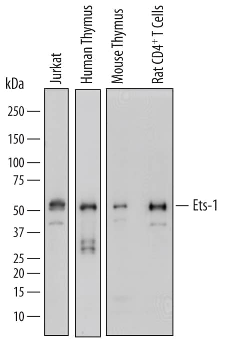 Western Blot Ets-1 Antibody [Unconjugated]