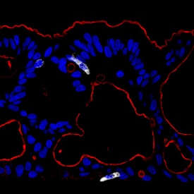 Ezrin was detected in immersion fixed paraffin-embedded sections of human colon stem cells differentiating into ascending colon using Sheep Anti-Human/Mouse/Rat Ezrin Antigen Affinity-purified Polyclonal Antibody (AF7239) at 0.5 µg/mL overnight at 4 °C. Tissue was stained using the NorthernLights™ 557-conjugated Anti-Sheep IgG Secondary Antibody (red; NL010). Chromogranin A was also detected using Mouse Anti-Human Chromogranin A Monoclonal Antibody (MAB90981) at 0.5 µg/mL overnight at 4 °C. Tissue was co-stained using the NorthernLights™ 637-conjugated Anti-Mouse IgG Secondary Antibody (red; NL008) and counterstained with DAPI (blue). Specific staining of Ezrin was localized to microtubules. View our protocol for Fluorescent IHC Staining of Frozen Tissue Sections.