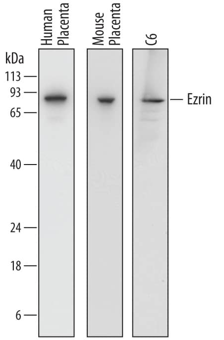 Western blot shows lysates of human placenta tissue, mouse placenta tissue, and C6 rat glioma cell line. PVDF membrane was probed with 0.2 µg/mL of Sheep Anti-Human/Mouse/Rat Ezrin Antigen Affinity-purified Polyclonal Antibody (Catalog # AF7239) followed by HRP-conjugated Anti-Sheep IgG Secondary Antibody (HAF016). A specific band was detected for Ezrin at approximately 81 kDa (as indicated). This experiment was conducted under reducing conditions and using Immunoblot Buffer Group 1.