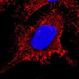 Ezrin was detected in immersion fixed HeLa human cervical epithelial carcinoma cell line using Rabbit Anti-Human/Mouse/Rat Ezrin Monoclonal Antibody (Catalog # MAB72391) at 3 µg/mL for 3 hours at room temperature. Cells were stained using the NorthernLights™ 557-conjugated Anti-Rabbit IgG Secondary Antibody (red; Catalog # NL004) and counterstained with DAPI (blue). Specific staining was localized to cytoplasm. View our protocol for Fluorescent ICC Staining of Cells on Coverslips.