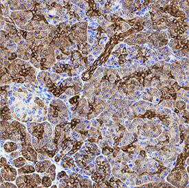 Ezrin was detected in immersion fixed paraffin-embedded sections of human pancreas using Rabbit Anti-Human/Mouse/Rat Ezrin Monoclonal Antibody (Catalog # MAB72391) at 1 µg/mL for 1 hour at room temperature followed by incubation with the Anti-Rabbit IgG VisUCyte™ HRP Polymer Antibody (Catalog # VC003). Tissue was stained using DAB (brown) and counterstained with hematoxylin (blue). Specific staining was localized to cytoplasm in exocrine cells. View our protocol for IHC Staining with VisUCyte HRP Polymer Detection Reagents.