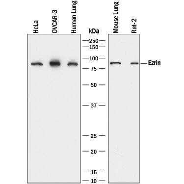 Western blot shows lysates of HeLa human cervical epithelial carcinoma cell line, OVCAR-3 human ovarian carcinoma cell line, human lung tissue, mouse lung tissue, and Rat-2 rat embryonic fibroblast cell line. PVDF membrane was probed with 0.2 µg/mL of Rabbit Anti-Human/Mouse/Rat Ezrin Monoclonal Antibody (Catalog # MAB72391) followed by HRP-conjugated Anti-Rabbit IgG Secondary Antibody (Catalog # HAF008). A specific band was detected for Ezrin at approximately 80 kDa (as indicated). This experiment was conducted under reducing conditions and using Immunoblot Buffer Group 1.