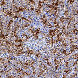 Ezrin was detected in immersion fixed paraffin-embedded sections of human pancreas using Rabbit Anti-Human Ezrin Monoclonal Antibody (Catalog # MAB7239) at 1 µg/mL for 1 hour at room temperature followed by incubation with the Anti-Rabbit IgG VisUCyte™ HRP Polymer Antibody (Catalog # VC003). Tissue was stained using DAB (brown) and counterstained with hematoxylin (blue). Specific staining was localized to cytoplasm in exocrine cells. View our protocol for IHC Staining with VisUCyte HRP Polymer Detection Reagents.